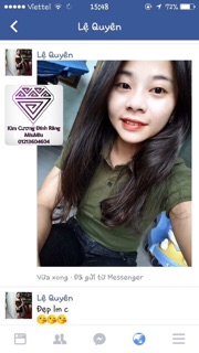 Đá mỹ đính răng loại 1