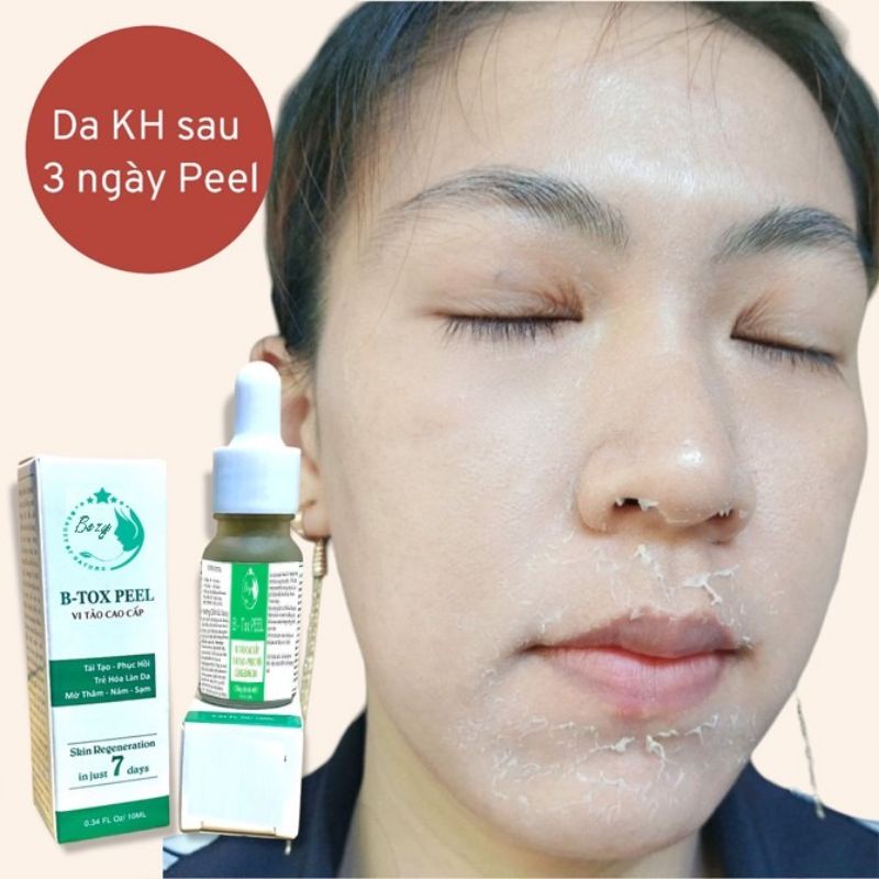Peel Hút Nám Bong Da Vi Tảo Trắng Da Bezy Cao Cấp