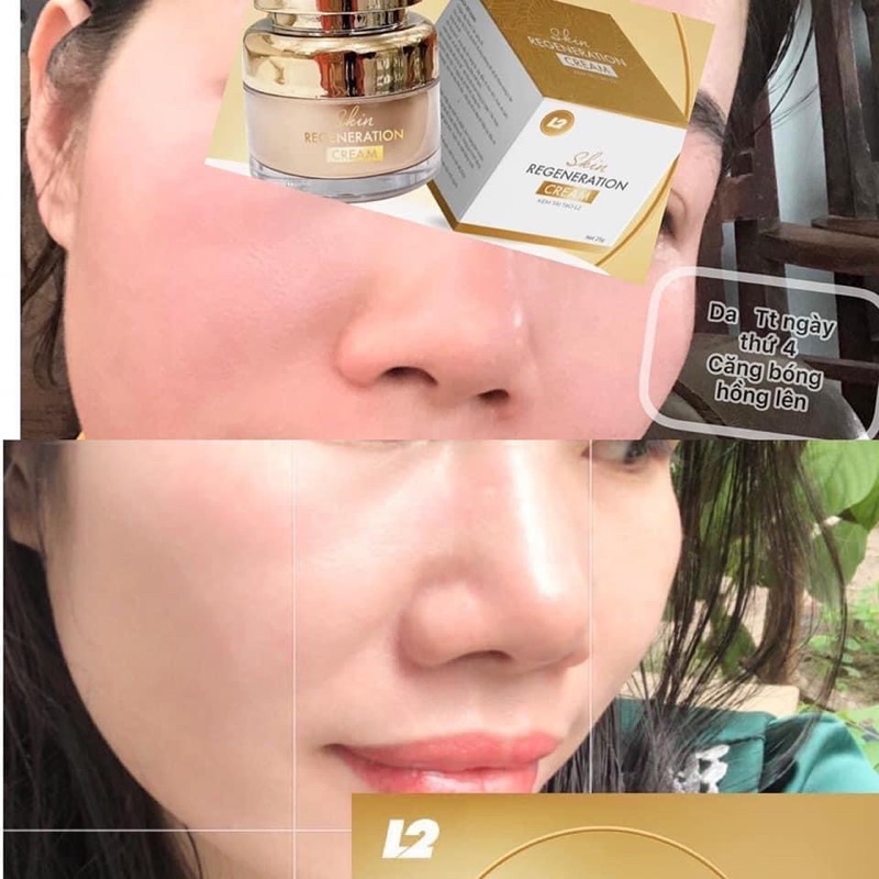 KEM TÁI TẠO DA L2 SKIN   𝐒𝐤𝐢𝐧 𝐑𝐞𝐠𝐞𝐧𝐞𝐫𝐚𝐭𝐢𝐨𝐧 𝐂𝐫𝐞𝐚𝐦 30gram