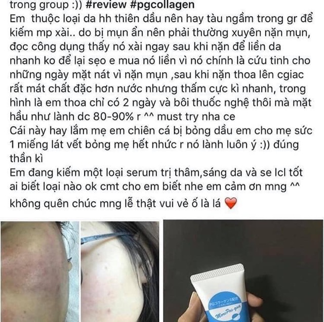 Pg Collagen phục hồi da mụn