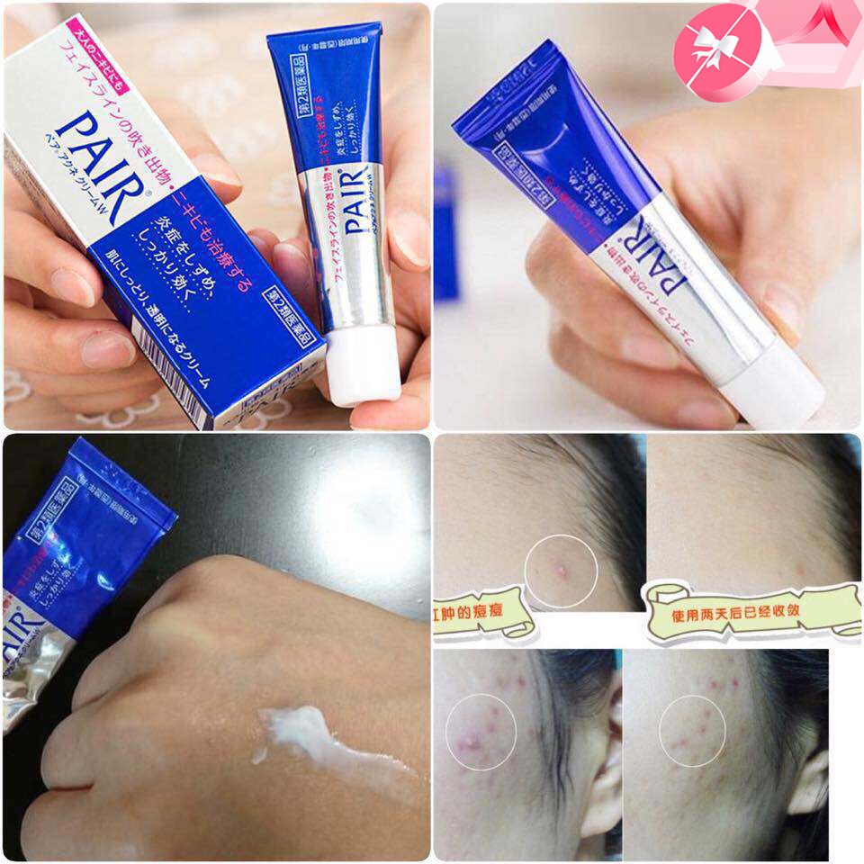 Kem ngừa mụn Pair Acne W Cream Nhật Bản 24g