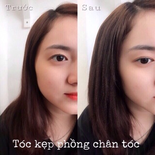 Kẹp phím phồng 2 bên