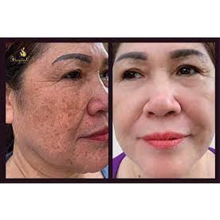 𝐓𝐮𝐲́𝐩 𝐧𝐚́𝐦, 𝐭𝐚̀𝐧 𝐧𝐡𝐚𝐧𝐠 𝐜𝐥𝐨𝐛𝐞𝐭𝐚𝐦𝐢𝐥 𝐆 𝐜𝐡𝐢́𝐧𝐡 𝐡𝐚̃𝐧𝐠 𝐭𝐡𝐚́𝐢 𝐥𝐚𝐧💖 𝐂𝐚𝐦 𝐤𝐞̂́𝐭 𝐬𝐚̣𝐜𝐡 𝐧𝐚́𝐦 , 𝐬𝐚̣𝐜𝐡 𝐭𝐚̀𝐧 𝐧𝐡𝐚𝐧𝐠 trắng da💖