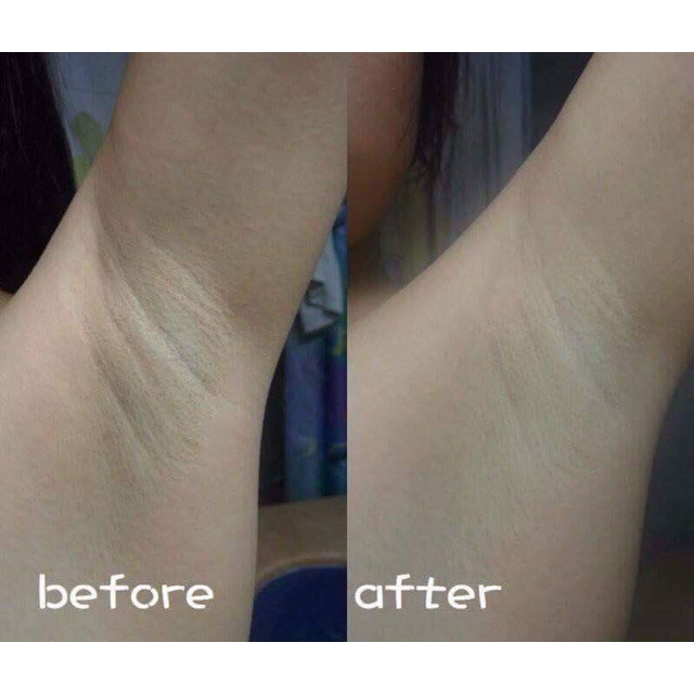 Xà Phòng Thâm Nách Pelican Nhật Bản | BigBuy360 - bigbuy360.vn