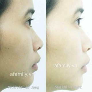 Kem giữ ẩm da vitamin E ̣ SIEU RE