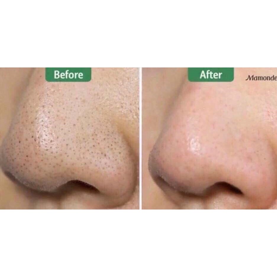 Thanh lăn giảm mụn đầu đen Mamonde Pore Clean Blackhead Stick