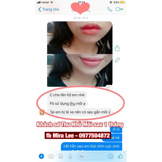 Tinh Chất Thu Nhỏ Môi Miracle