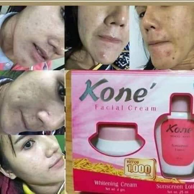 Kem Facial Cream Kone Thái Lan | BigBuy360 - bigbuy360.vn