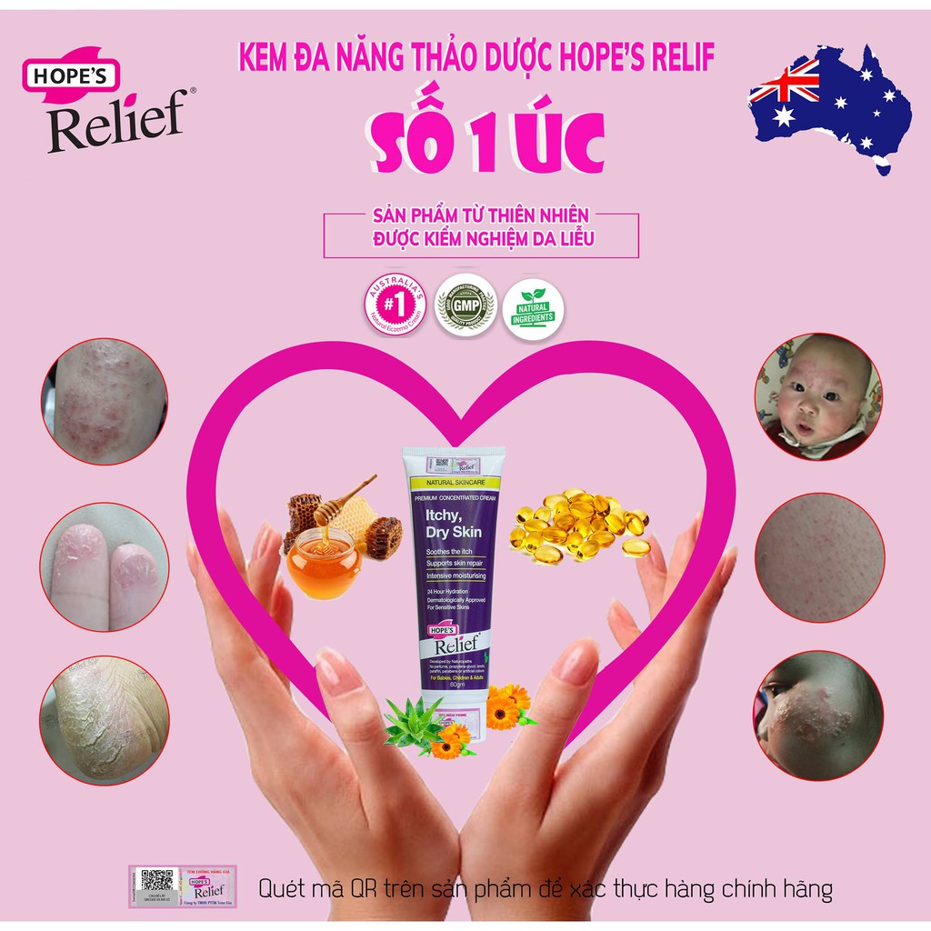 [Tặng Quà] Kem đa năng thảo dược Hope's Relief Premium concentrated Cream Itchy, Dry Skin 60g