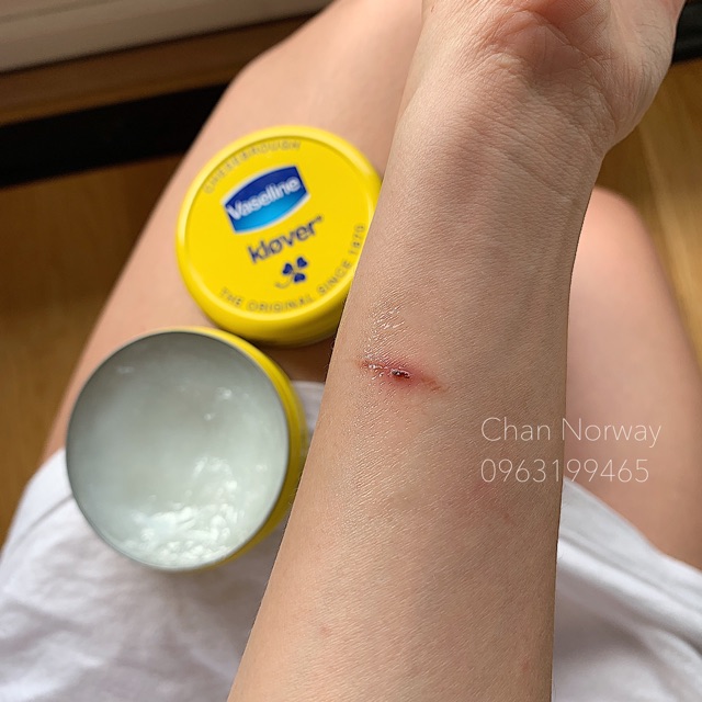 [TOP 1 SHOPEE] Vaseline Klover dưỡng ẩm Nauy 🇳🇴