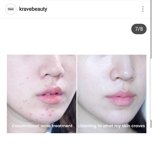 Krave Beauty_Toner tẩy da chết AHA Krave Kale-Lalu-YAHA | BigBuy360 - bigbuy360.vn
