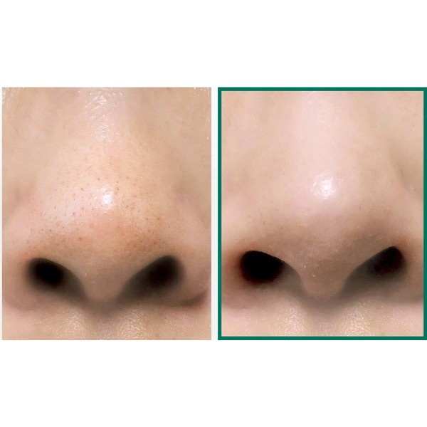 Kem Dưỡng Giảm Và Ngăn Ngừa Mụn Some By Mi AHA-BHA-PHA 30 Days Miracle Cream 50ml