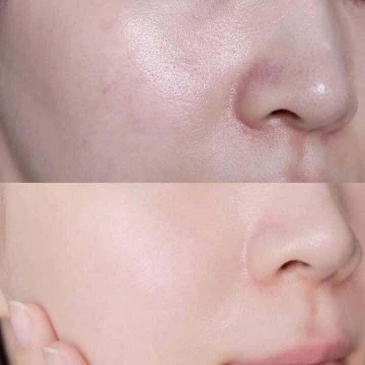 SKIN1004 - Toner Rau Má Cân Bằng Độ pH Phục Hồi Và Tái Tạo Da 210ml