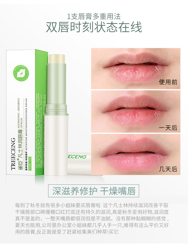 [Hàng mới về] Son dưỡng Vaseline ẩm chống khô môi cho nam và nữ | BigBuy360 - bigbuy360.vn
