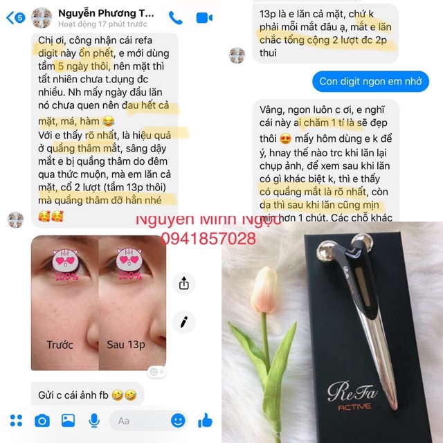 Refa Active Digit - Cây Mát Xa Nâng Cơ, Xoá Nhăn, Chống Lão Hoá