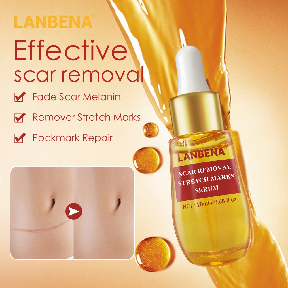 Set 2 Mỹ Phẩm Chăm Sóc Da LANBENA Gồm Serum Xóa Sẹo Mụn+Kem Làm Trắng Mụn Đầu Đen Thu Nhỏ Lỗ Chân Lông Làm Mờ Vết Rạn Da | BigBuy360 - bigbuy360.vn