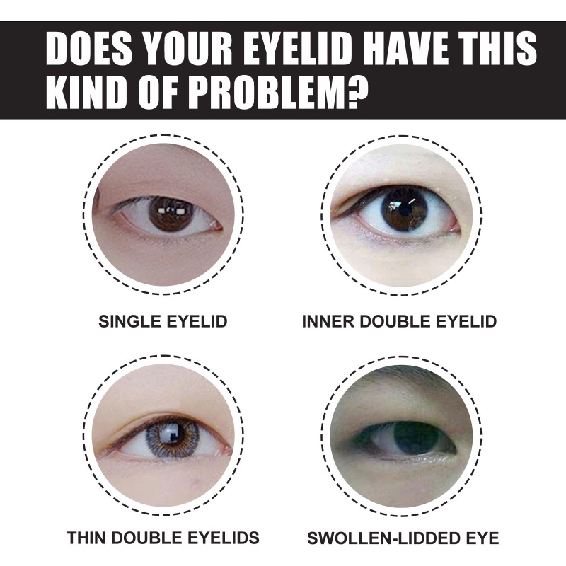 Whi Bộ Miếng Dán Kích Mí Vô Hình Cho Saggy Hood Droopy Uneven Mon