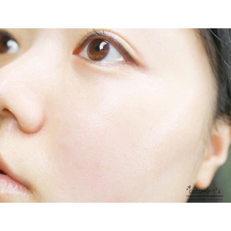 Tế bào gốc Eldas