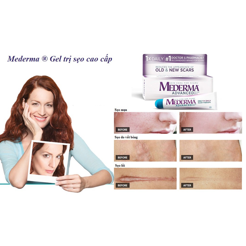 Kem giảm sẹo Mederma Advanced Scar Gel 20g