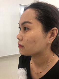Set lẻ GEL NÂNG CƠ THẢI ĐỘC CARE CELLA