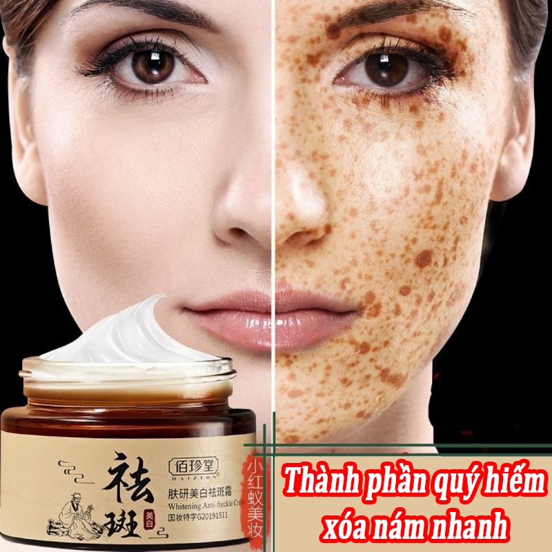 Kem xóa tàn nhang kem xóa nám làm trắng da tinh chất chất làm trắng da mặt và loại bỏ nám làm sáng da chăm sóc