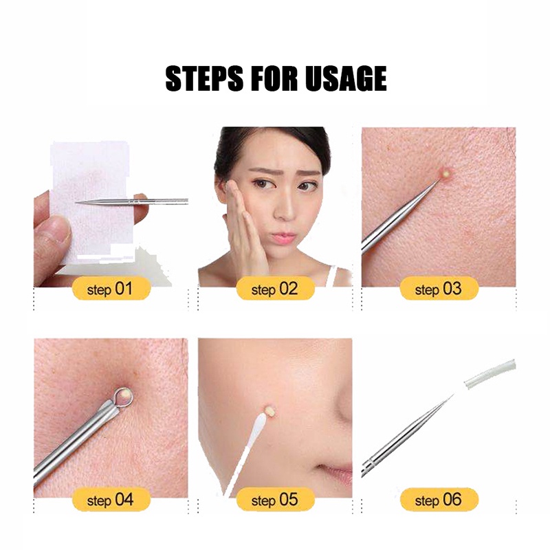 Bộ 4 Dụng Cụ Loại Bỏ Mụn Đầu Đen Làm Sạch Lỗ Chân Lông Chăm Sóc Da Mặt