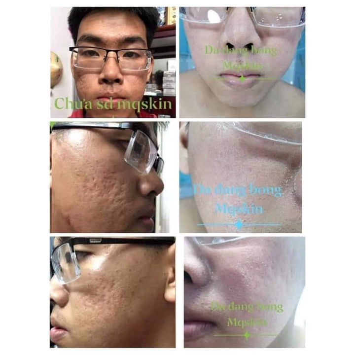 Combo 3 Chai Serum Tái Tạo Da Sâm Cao Rừng MQ SKIN