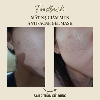 COMBO mặt nạ thải độc da - mặt nạ giảm mụn handmade