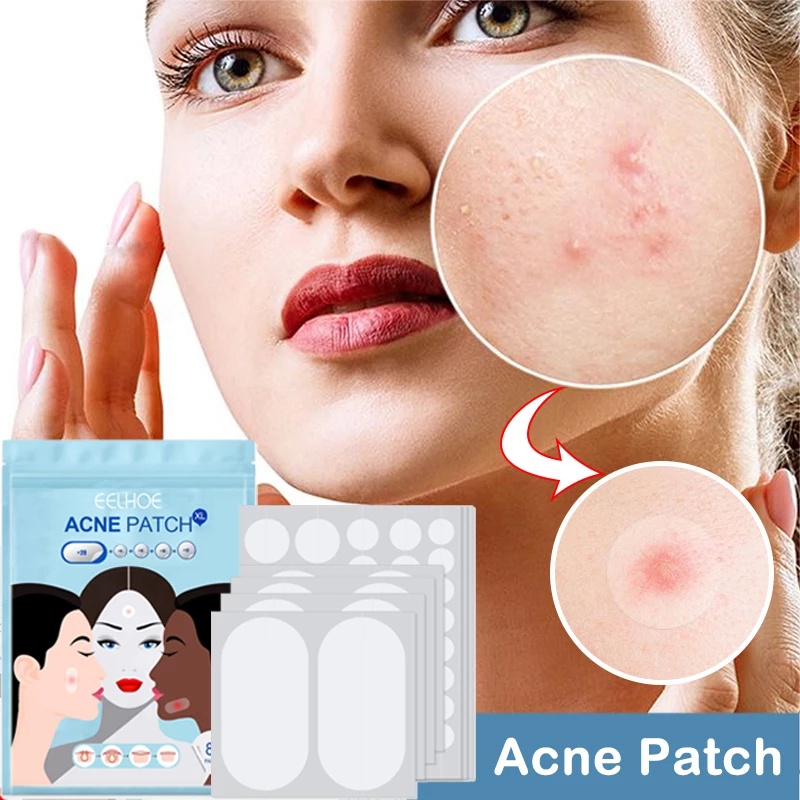 Set 80 Miếng Dán Hỗ Trợ Giảm Mụn Vô Hình Chống Thấm Nước