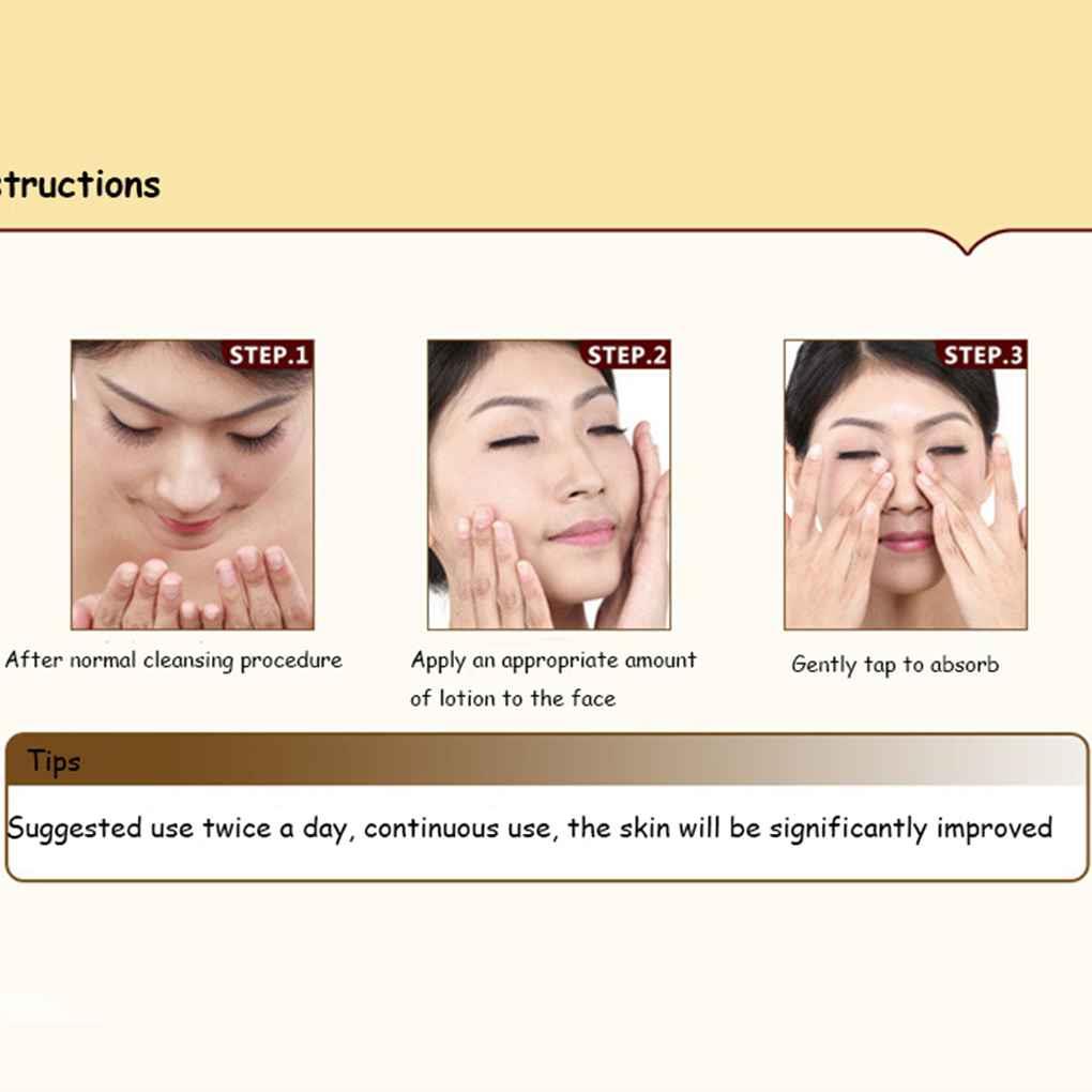 Tinh Chất Ngọc Trai 35g Chứa Collagen Dưỡng Ẩm Chống Nếp Nhăn Làm Trắng Da