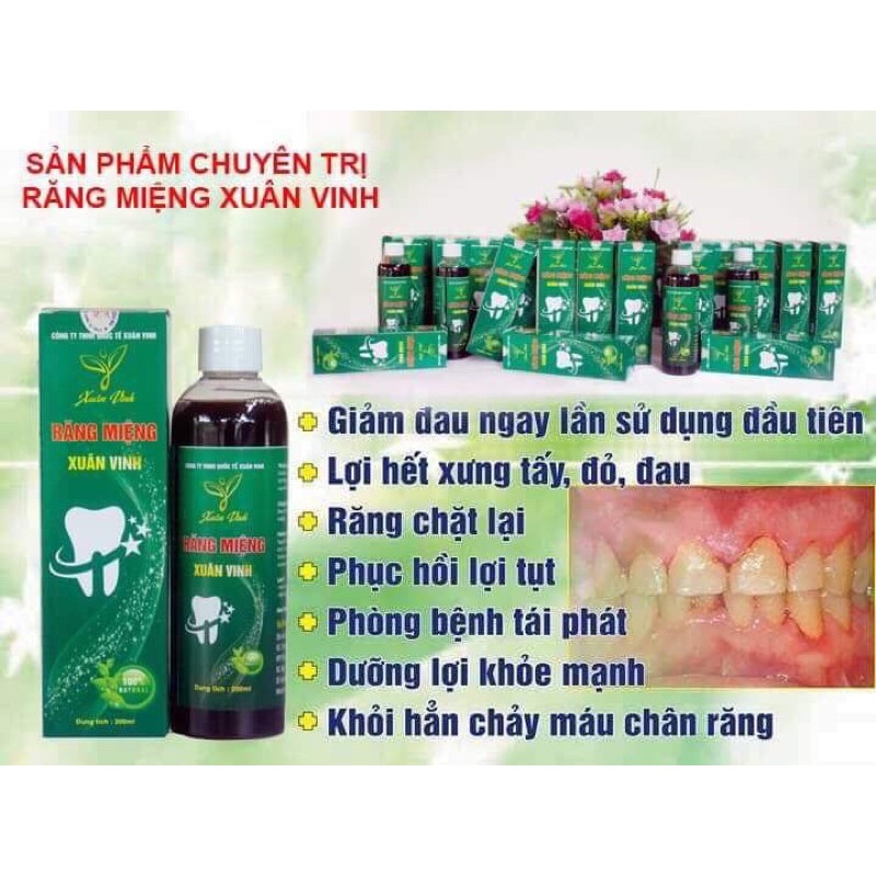 Nước Súc Miệng Thảo Dược Xuân Vinh 200ml Hết Hôi Miệng, Đau Răng, Nhiệt Miệng Sau Một Lần Sử Dụng