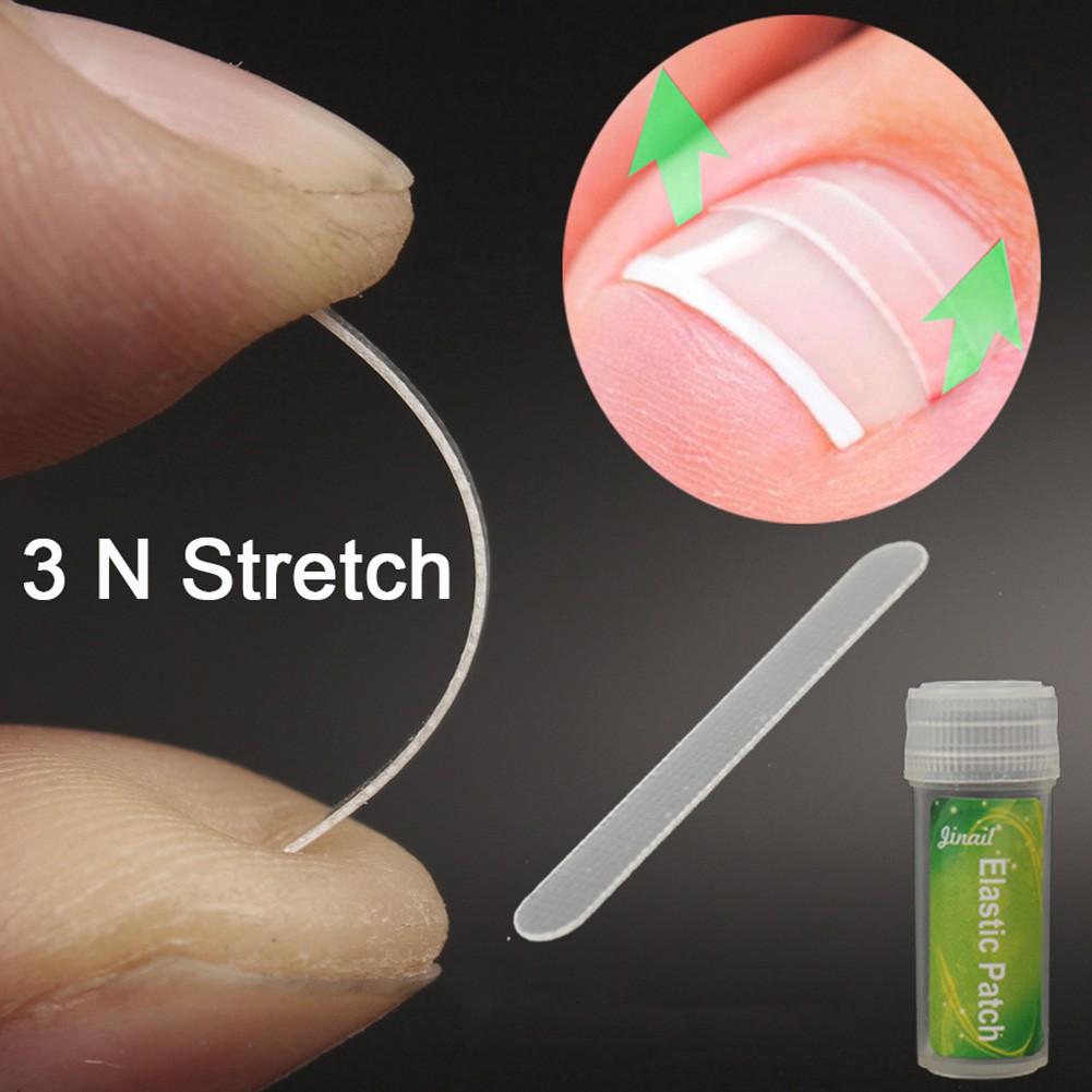Bộ 10 miếng dán điều chỉnh móng chân mọc ngược 3mm / 3.5mm / 4mm