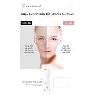 Sữa Rửa mặt Weilaiya Amino Acid