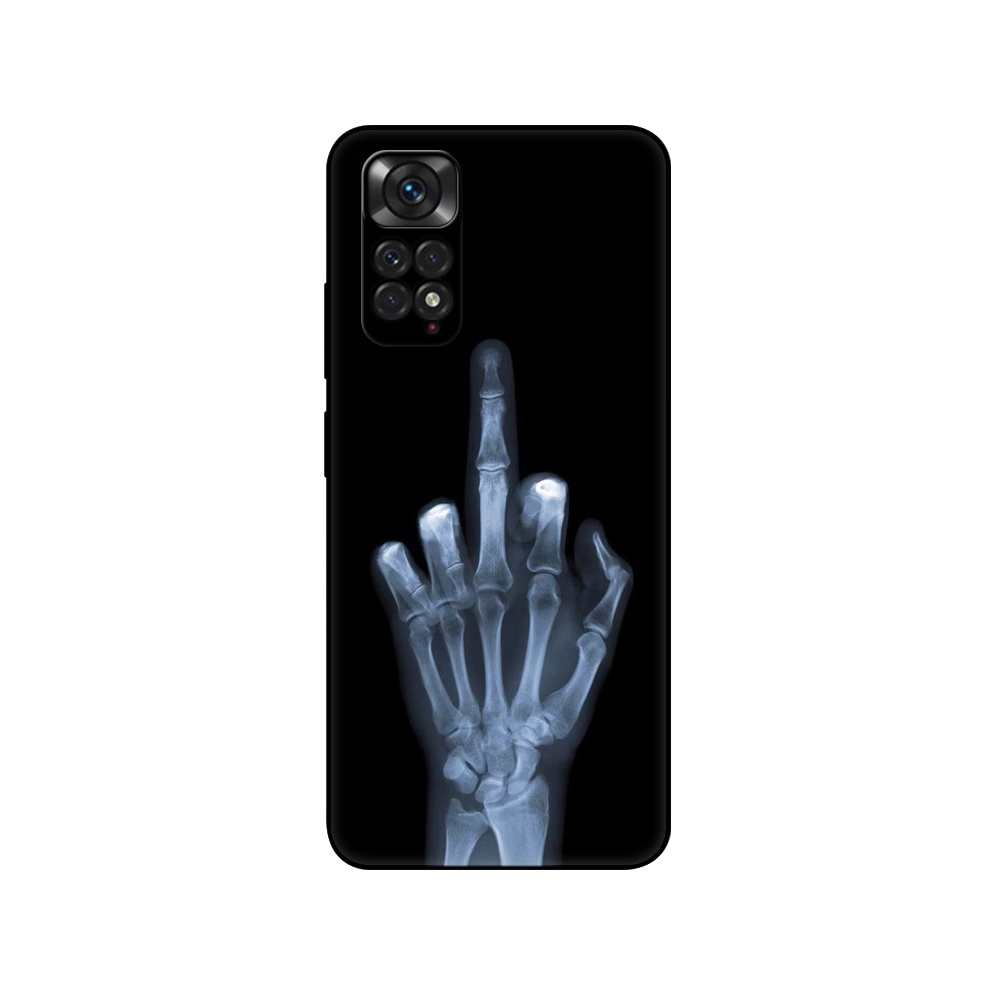Ốp Điện Thoại tpu Màu Đen Cho Xiaomi Redmi Note 11 4G Note 11S 4G Note11