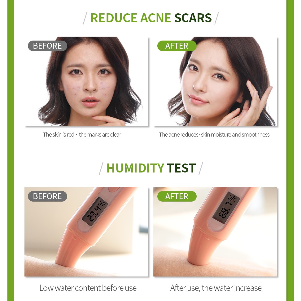 Sữa Rửa Mặt LAIKOU 120g Chiết Xuất Trà Xanh Kiềm Dầu Chăm Sóc Da Hiệu Quả