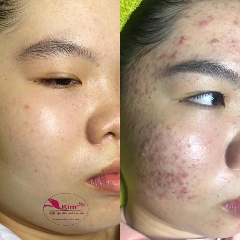 Kem Dưỡng Da Mặt Sau Tái Tạo Độc Quyền Kim Spa Số 33 Dưỡng Trắng Mịn Sáng Da