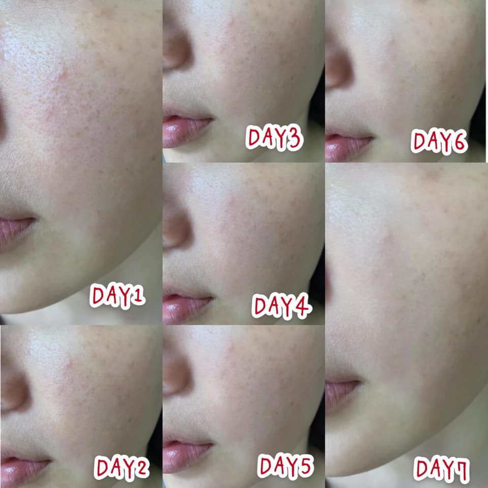 DR.WU Serum Tái Tạo Da Mandelic Acid 8% và 18%