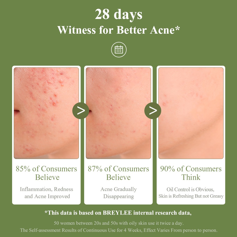 BREYLEE 15g Hỗ Trợ Chăm Sóc Gel Da Và Loại Bỏ Mụn