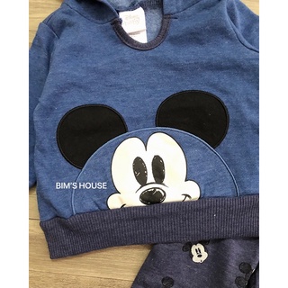 Sét bộ micky