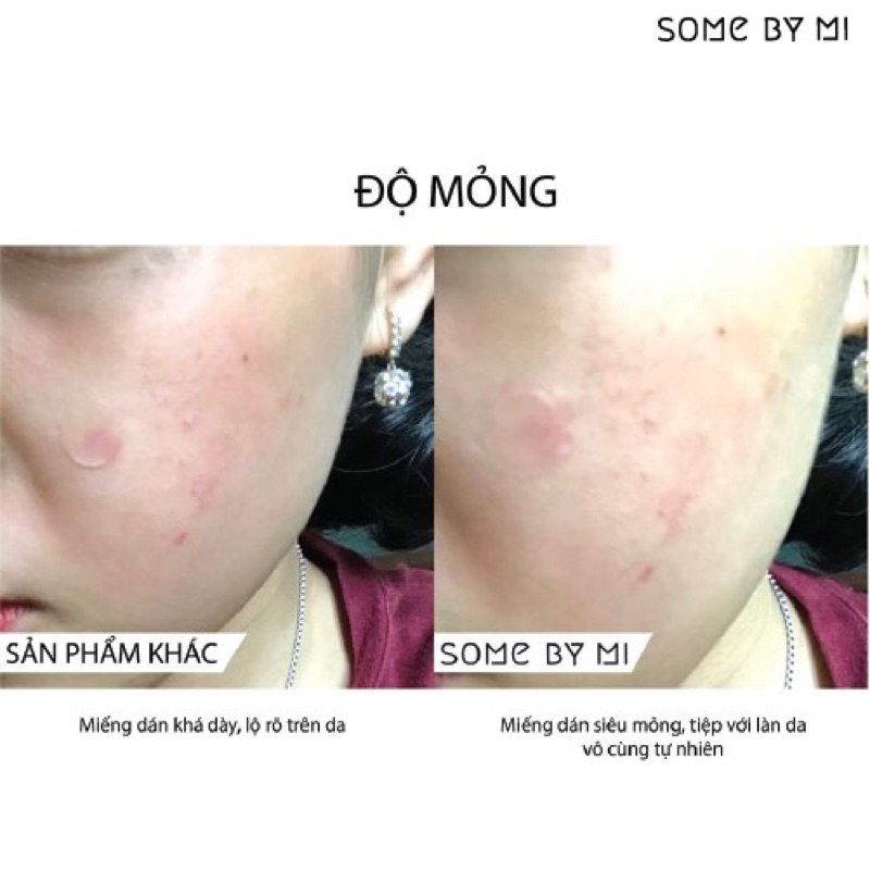 Miếng Dán Mụn Some By Mi Clear Spot Patch