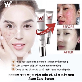 Kem giảm mụn It’s Well plus 15ml