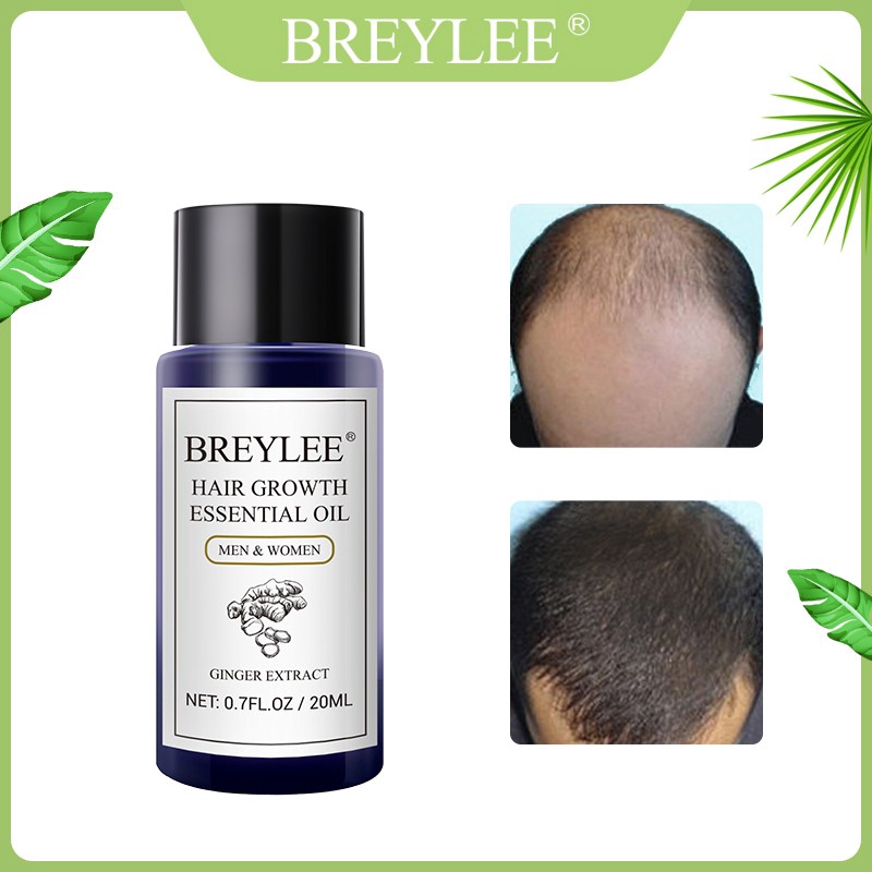 Tinh dầu nuôi dưỡng kích thích mọc tóc BREYLEE | BigBuy360 - bigbuy360.vn