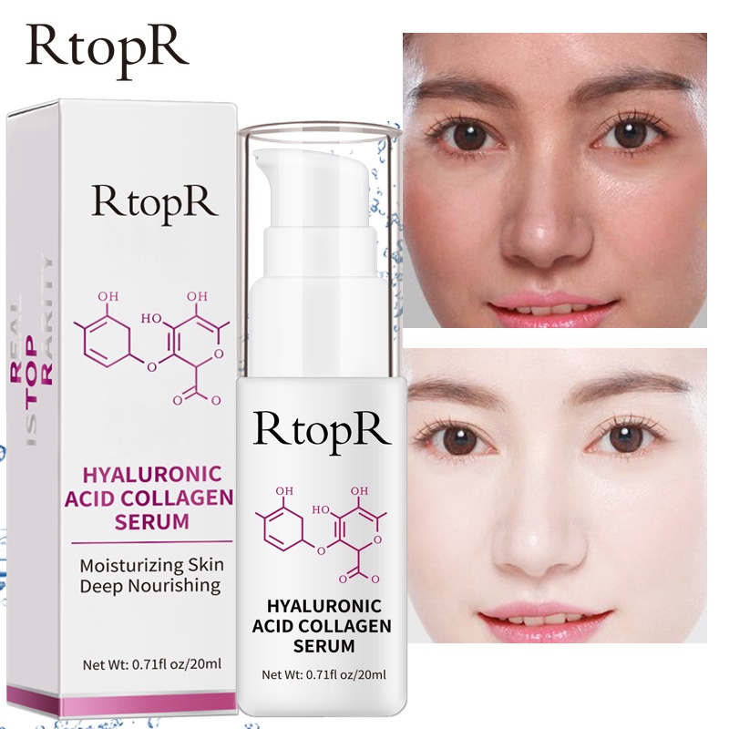 Tinh Chất Dưỡng RtopR Từ Hyaluronic Acid Collagen Hỗ Trợ Giảm Mụn Chống Nếp Nhăn Làm Trắng Da 20ml