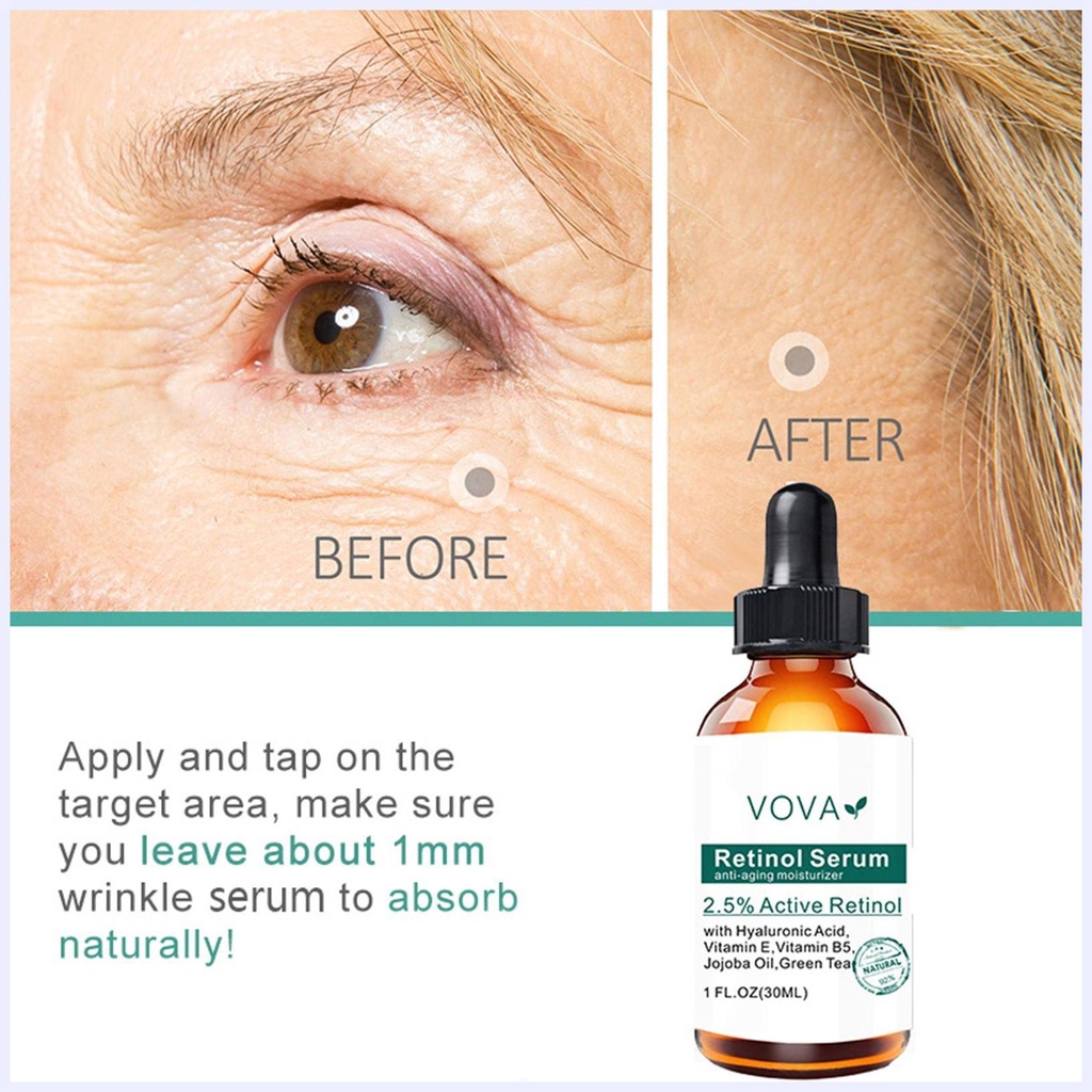 Serum Retinol 2.5 Retinol Chống Lão Hóa Se Khít Lỗ Chân Lông Làm Mờ Vết Thâm Làm Sáng Da