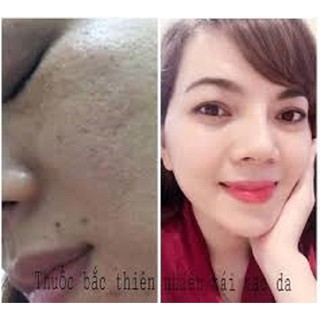 thuốt bắc tái tạo da 50ml