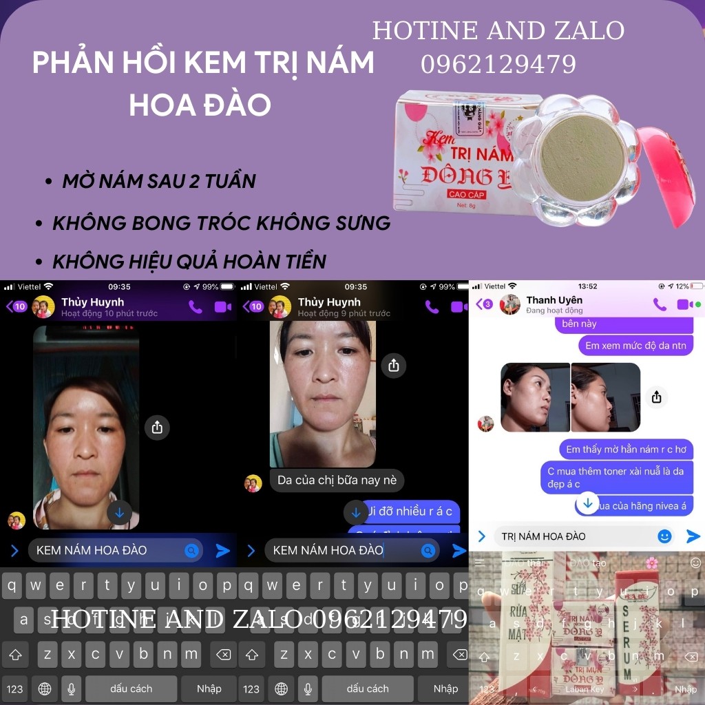 Kem nám đông y mờ nám, dưỡng trắng da, mờ thâm-Zini store | BigBuy360 - bigbuy360.vn