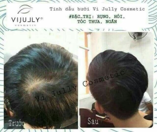 Tinh Dầu Bưởi Vi Jully 100% Thiên Nhiên Giúp Tóc Nhanh Dài, Mọc Tóc Nhanh