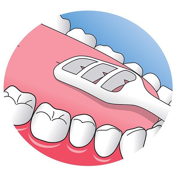 Cạo lưỡi chuẩn Nha Khoa- Cây làm sạch lưỡi piksters SDDS Chính Hãng Đức