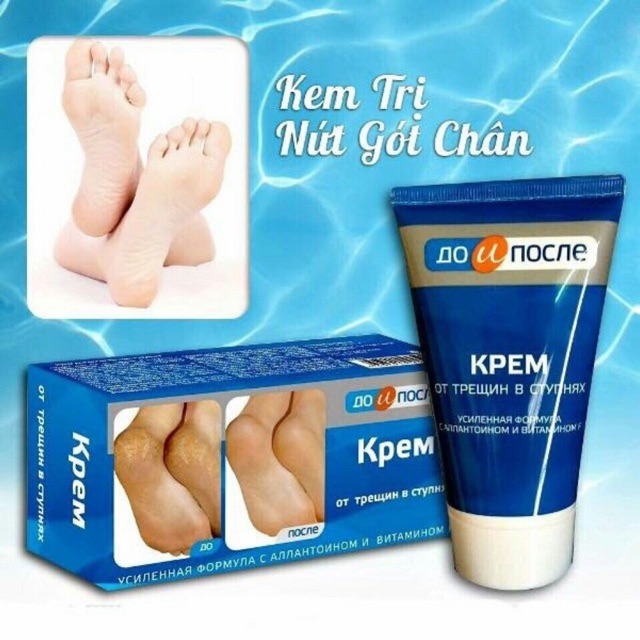 Kem trị nứt gót chân Kpem Apteka