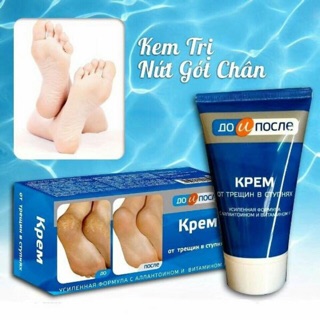 Kem trị nứt gót chân Kpem Apteka